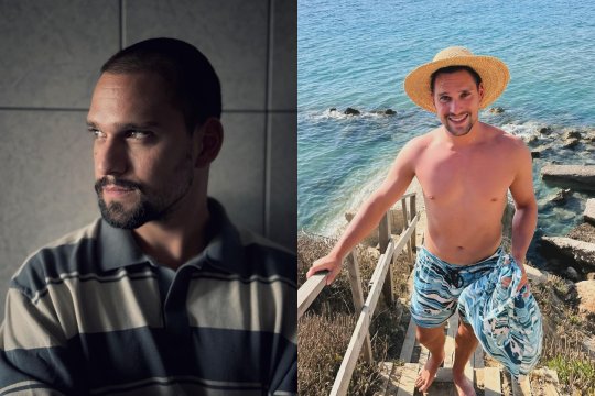 Vlad Gherman se află la recuperare, după intervenția de implant de păr. Actorul a vorbit despre întreaga procedură