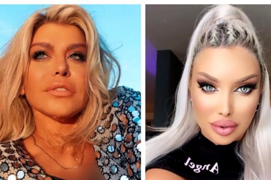 Acuzată că s-a transformat în Loredana Chivu, Loredana Groza spune adevărul despre operațiile estetice: „Este absolut vizibil”