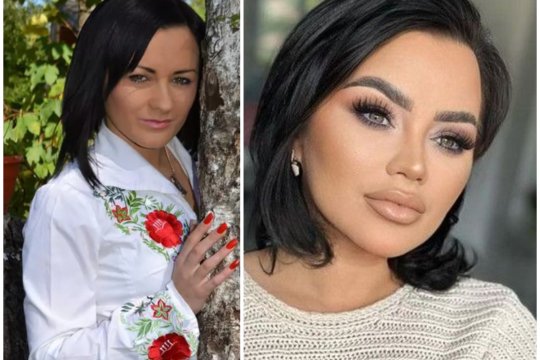 Câte operaţii estetice are Carmen de la Sălciua? "Mi-a schimbat forma feţei"