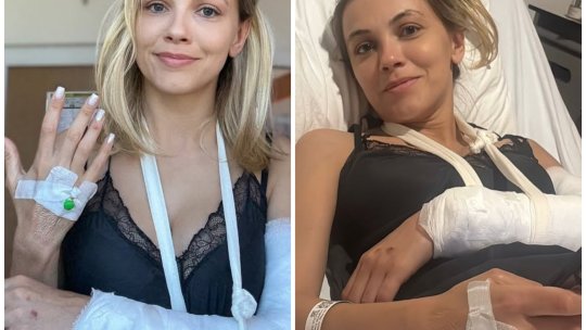 Andreea Ibacka, despre cum a trecut peste accidentul de motocicletă, alături de Cabral! A fost afectată și psihic