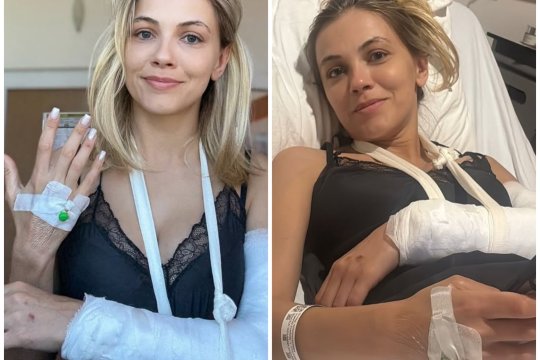 Andreea Ibacka, despre cum a trecut peste accidentul de motocicletă, alături de Cabral! A fost afectată și psihic