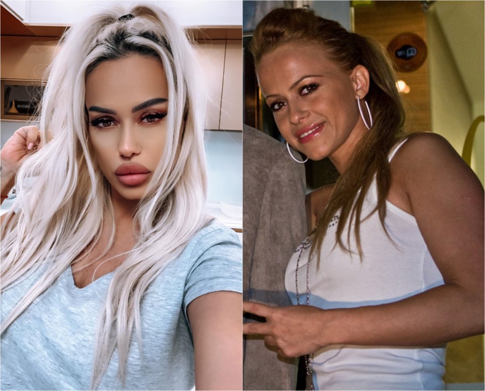 Anda Adam, înainte și după operațiile estetice