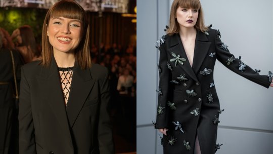 Alexandra Ungureanu a rămas cu sechele după o procedură de înfrumusețare. Ce a pățit artista