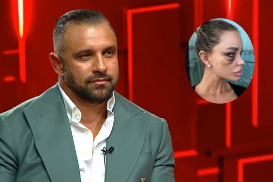 Alex Bodi n-a mai suportat și a spus adevărul! A bătut-o sau nu afaceristul pe Bianca Drăgușanu: ''Îmi place să vânez''