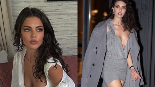 Cristina Ich, probleme neașteptate în urma unei proceduri estetice populare: „Trei luni de recuperare”